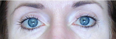 Eyes After Anti-Aging Skin Care Product