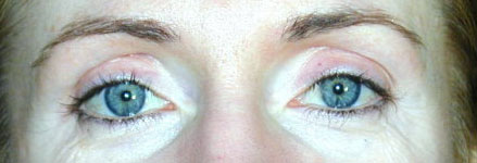 Eyes Before Anti-Aging Skin Care Product