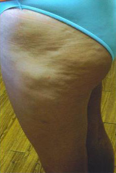 Legs Before